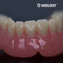 Denture Base Polymers