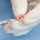 HF-Etchant Hydrofluoric Acid Etching Gel