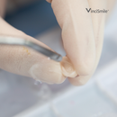 HF-Etchant Hydrofluoric Acid Etching Gel